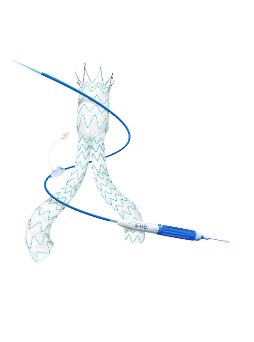 Minos?腹主動脈覆膜支架及輸送系統-1