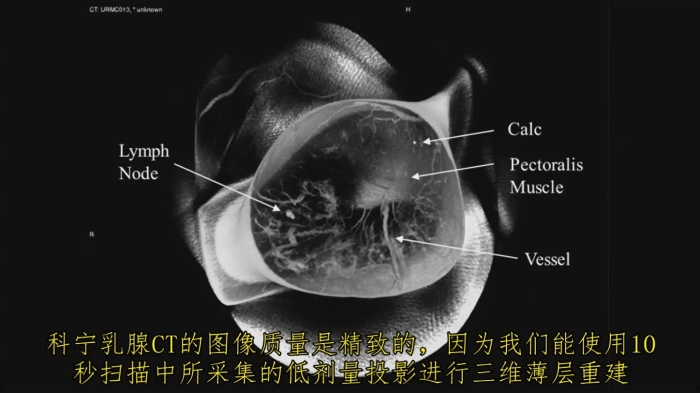 KBCT產(chǎn)品優(yōu)勢4-2
