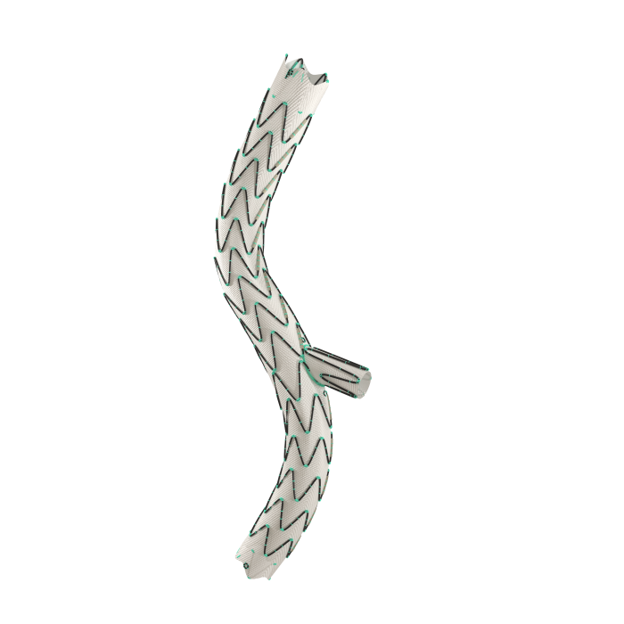 照片2-先健科技-髂動(dòng)脈分叉支架